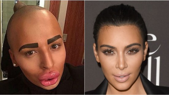 英男粉絲斥巨資百萬(wàn)整容成男版金&bull;卡戴珊